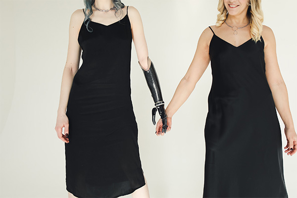 ¿Qué pasa cuando es tu mejor amigo el que acaba de perder una extremidad?